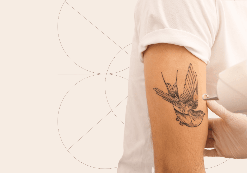 Laser Tattoo Removal