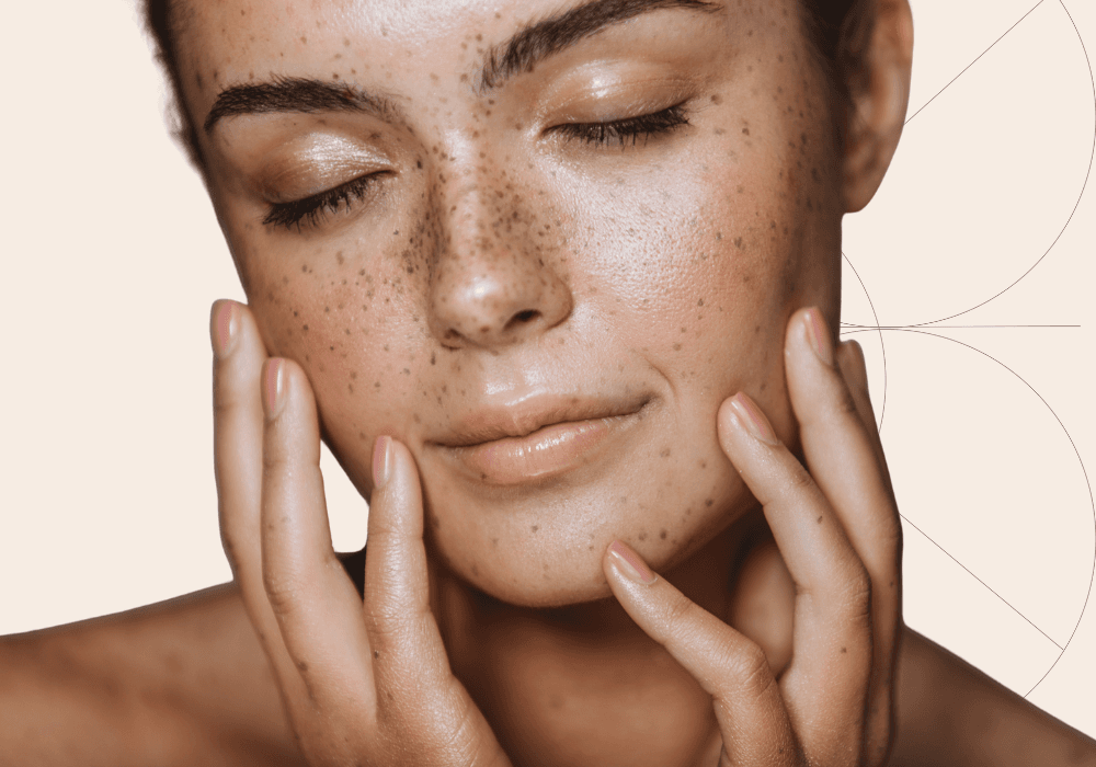 Pigmentation Correction