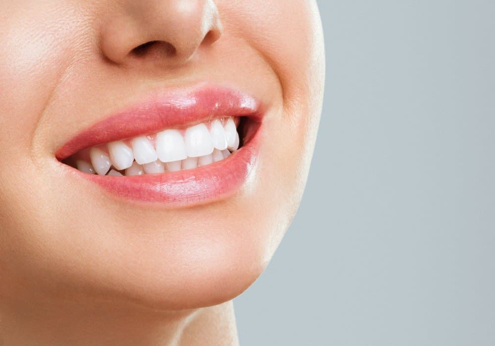 Smile enhancement