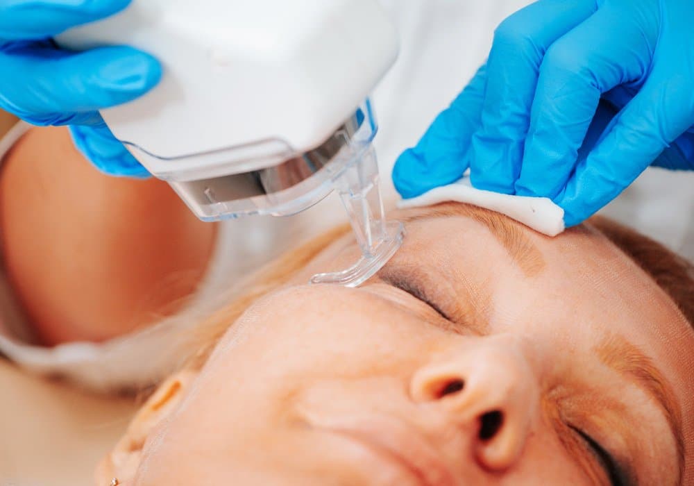 Laser Wrinkle Removal