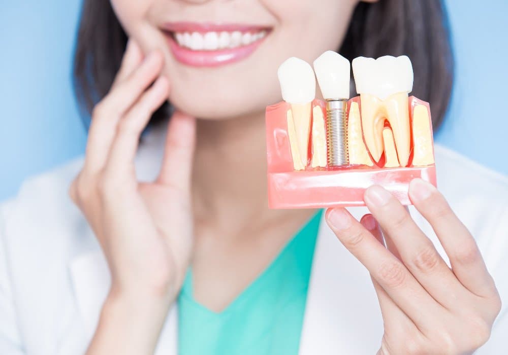 Dental Implants